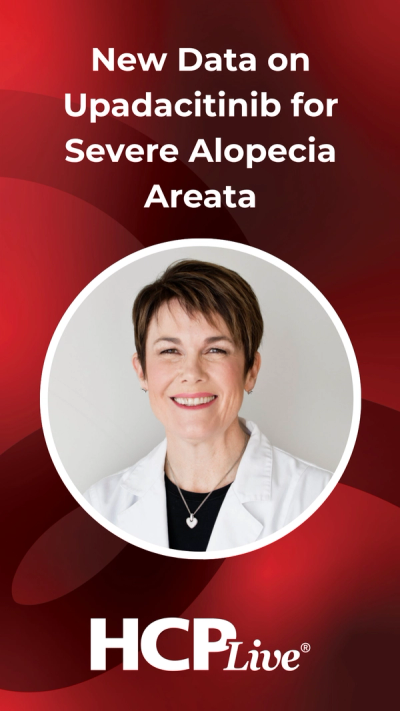 Hair Regrowth: New Data on Upadacitinib for Severe Alopecia Areata
