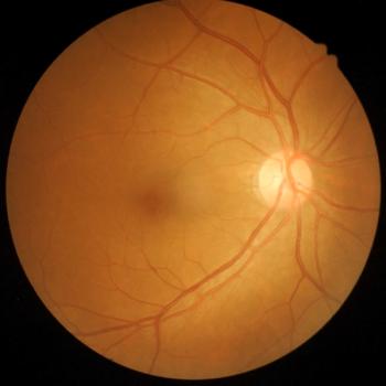 Retinal Atrophy Risk May be Signaled by Presence of OCT Features, Study Suggests | Image Credit: Adobe Stock