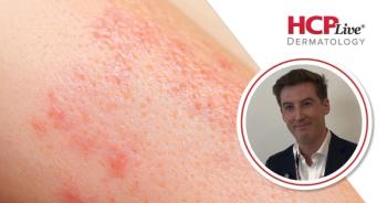 Upadacitinib Feasible for Palmoplantar Pustulosis: David Gleeson, BM BCH, PhD