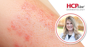 How Should Dermatology Clinicians Address Online Myths? With Shannon Trotter, DO