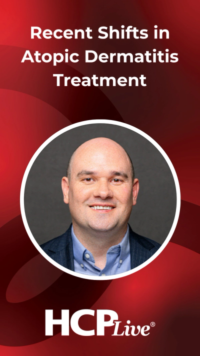 Recent Shifts in Atopic Dermatitis Treatment