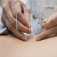 New Trial Tests Acupuncture as a Viable Irritable Bowel Syndrome Treatment