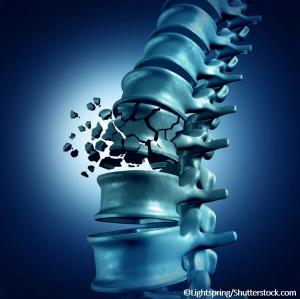 Endocrinology News Quiz: Obesity and Osteoporosis