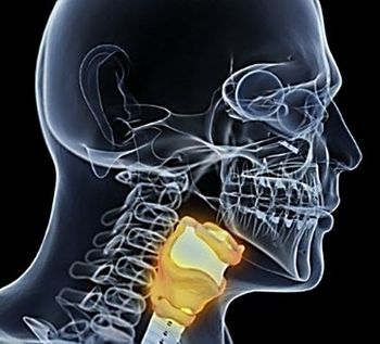Hypothyroid, hypothyroidism, atrial fibrillation, free thyroxine