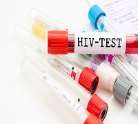 infectious disease, HIV, AIDS, pharmacy, tenofovir