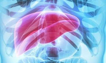 Liver cirrhosis | Credit: Adobe Stock