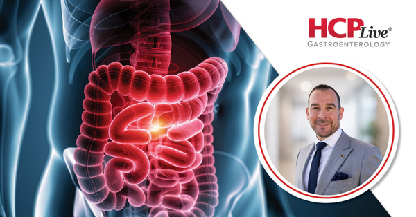 ABTECT Part 2 Data: Obefazimod Sustains Remission in UC