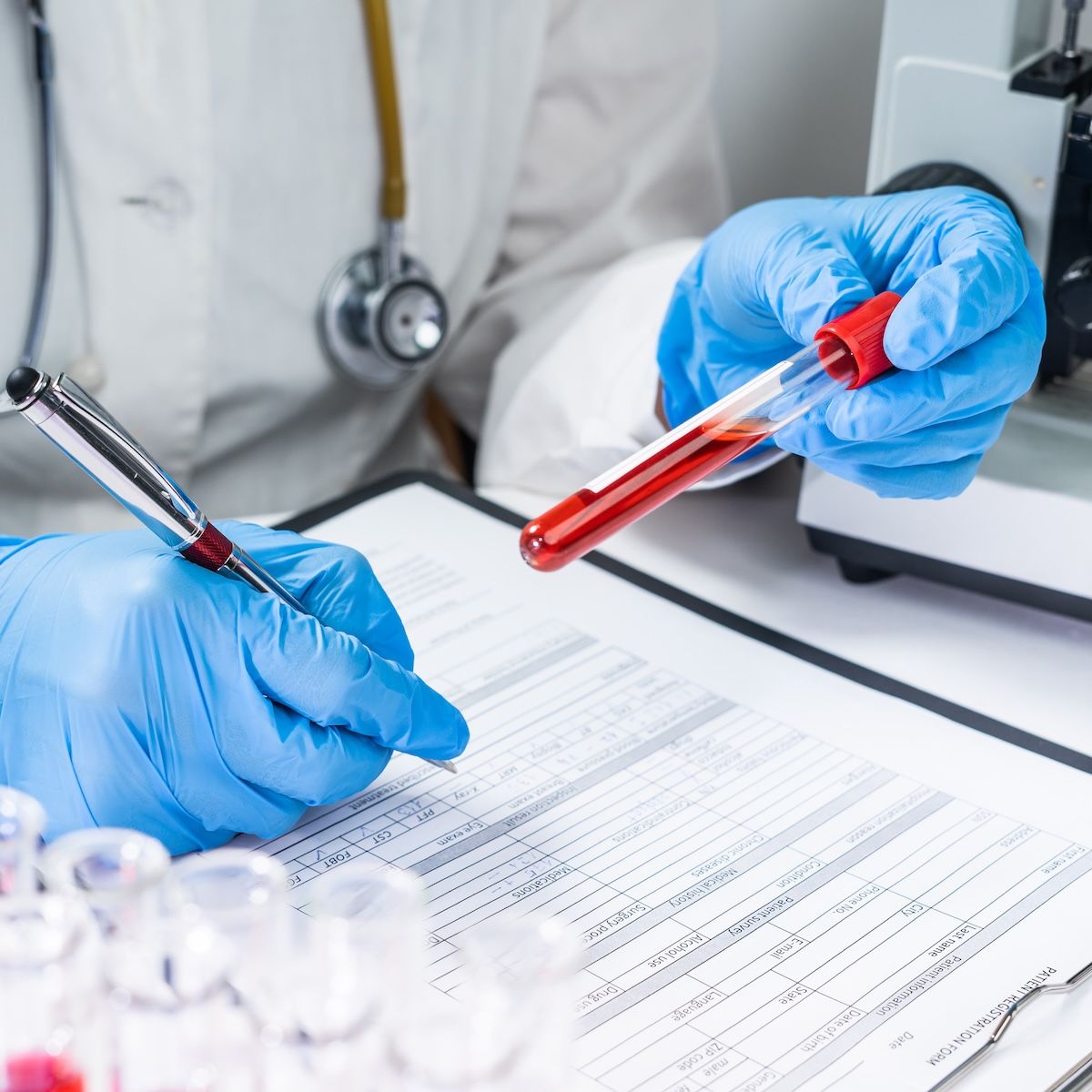 Connection Found Between Angiopoietin-Like Proteins 3 and 4 and Dyslipidemia | Image Credit: Adobe Stock