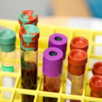 Trials Indicate Efficacy of Thalidomide to Treat Sickle Cell Anemia | Image Credit: Unsplash