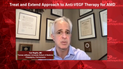 EP. 3 Treat and Extend Approach to Anti-VEGF Therapy for AMD