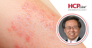 Expert Consensus on Knowledge Gaps in Dermatology for Skin of Color, With Henry Lim, MD
