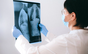 People with Autoimmune Diseases on Immunosuppressants Face Higher Fracture Risk