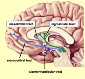 Sex, Drugs, and Video Games (in Parkinson's Disease)