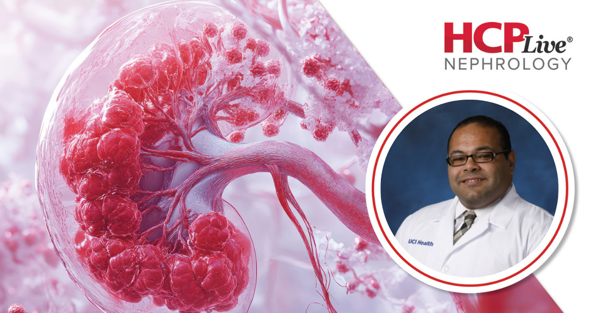 Early Detection and Treatment Advances in IgA Nephropathy, With Ramy Hanna, MD