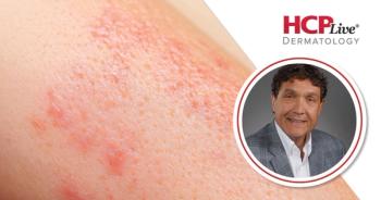 Jonathan A. Bernstein, MD Credit: Advanced Allergy Services