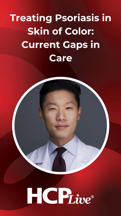 Treating Psoriasis in Skin of Color: Current Gaps in Care