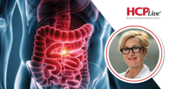 DUET-UC Data Highlight Potential of Dual-Pathway Targeting in Refractory Ulcerative Colitis