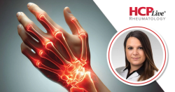 Lupus Disease Activity Correlates With Cognition, With Carla Marie Cuda, PhD