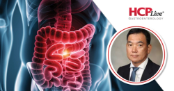 ESD May Offer Both Survival and Cost Advantages Over Esophagectomy for Early Esophageal Cancer