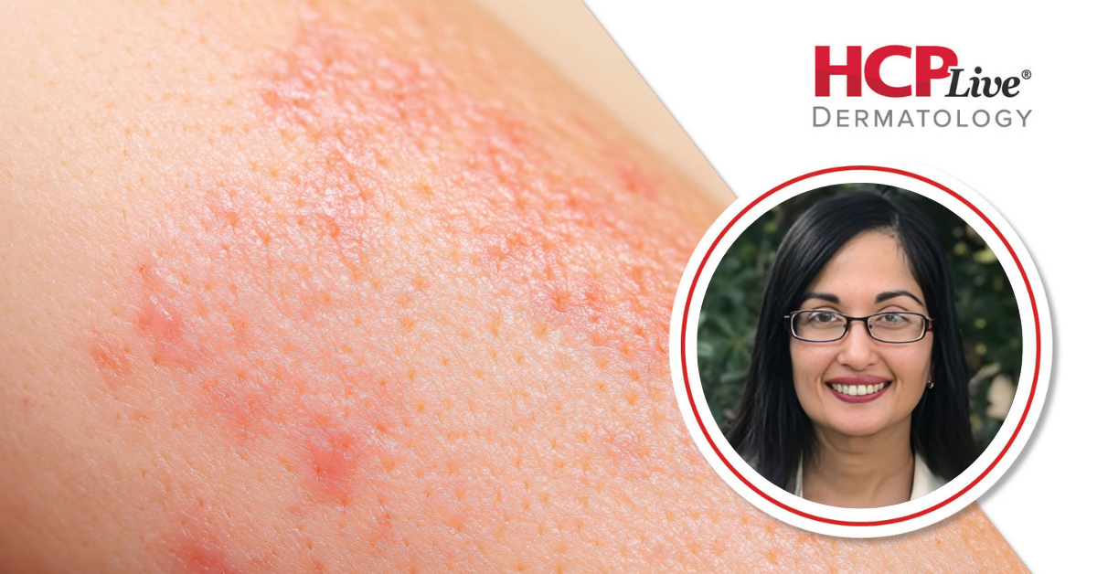 Diet and Dermatology: What to Say When Your Patients Ask