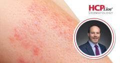 What Will Precision Dermatology Look Like in Atopic Dermatitis?