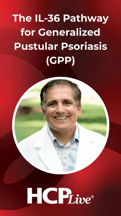 The IL-36 Pathway for Generalized Pustular Psoriasis (GPP)