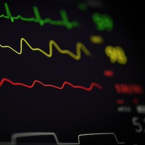 Heart rhythm | Image Credit: Joshua Chehov/Unsplash