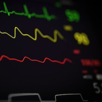 Heart rhythm | Image Credit: Joshua Chehov/Unsplash
