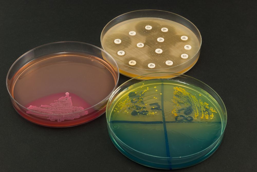 Diabetes Patients and Staph Infection Risk