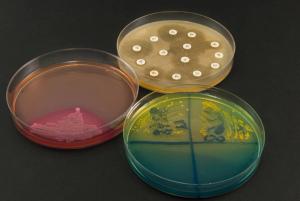 Diabetes Patients and Staph Infection Risk