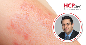 Discussing New Phase 3 Results on Dupilumab for Prurigo Nodularis, With Shawn Kwatra, MD