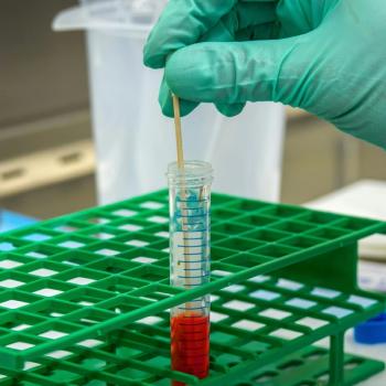 Ferric Citrate Hydrate Successfully Treats Iron Deficiency Anemia, Study Finds | Image Credit: Unsplash