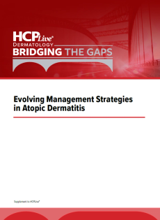 Evolving Management Strategies in Atopic Dermatitis