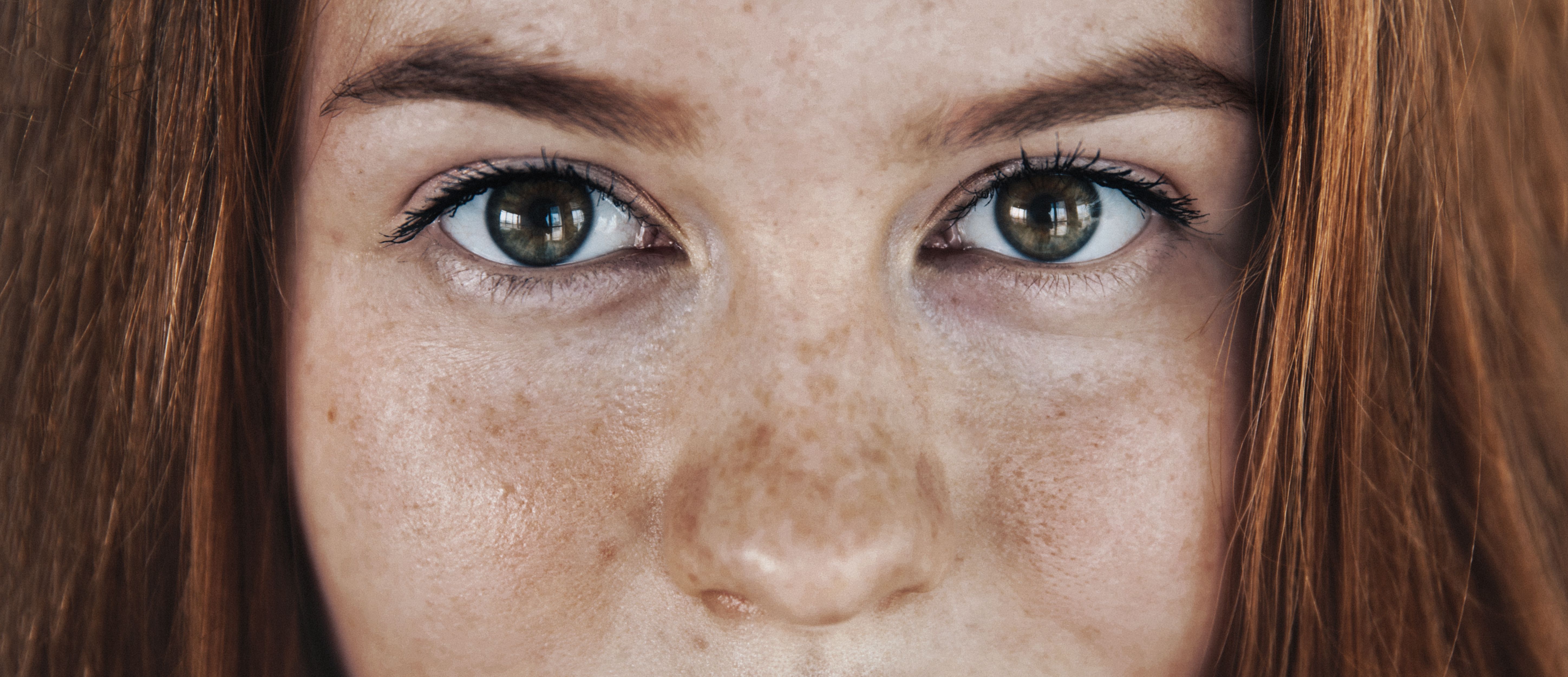 Diabetes complications in young adults with type 2 diabetes