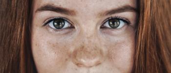 Diabetes complications in young adults with type 2 diabetes