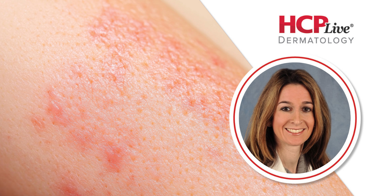 Management of Pediatric Atopic Dermatitis in Contemporary Settings, With Vivian Hernandez-Trujillo, MD