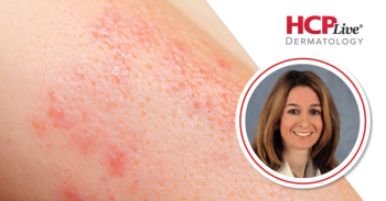 Management of Pediatric Atopic Dermatitis in Contemporary Settings, With Vivian Hernandez-Trujillo, MD