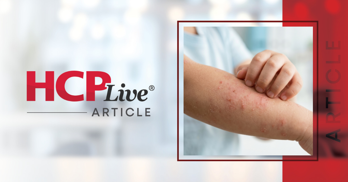 Dupilumab Improves Growth, Skin, & Caregiver Burden Across Pediatric AD Spectrum