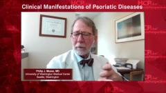 EP. 1 Clinical Manifestations of Psoriatic Diseases