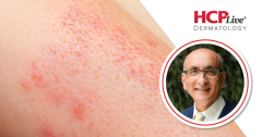 Why Molluscum No Longer Means Watch and Wait, With Leon Kircik, MD