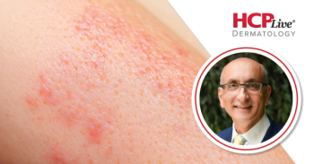Why Molluscum No Longer Means Watch and Wait, With Leon Kircik, MD