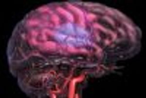 Is the Stroke Caused by a Hypercoagulable State?