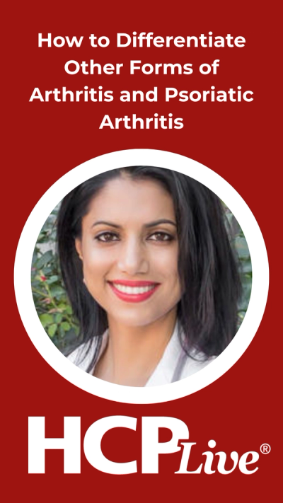 How to Differentiate Other Forms of Arthritis and Psoriatic Arthritis
