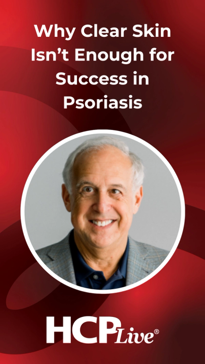 Why Clear Skin Isn’t Enough for Success in Psoriasis
