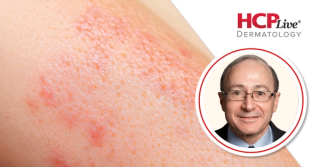 Phase 3b Data on Ixekizumab, Tirzepatide for Psoriasis and Overweight, With Mark Lebwohl, MD