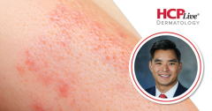 Emerging Evidence in Atopic Dermatitis Management, With Harrison Nguyen, MD, MBA, MPH