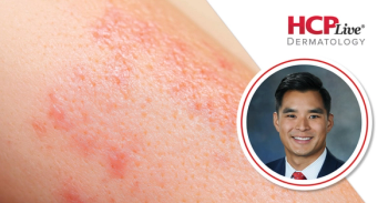 Discussing Treatment Strategies for Blistering Disorders, With Harrison Nguyen, MD, MBA, MPH