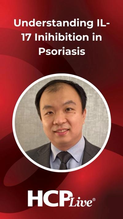 Understanding IL-17 Targeting in Psoriasis