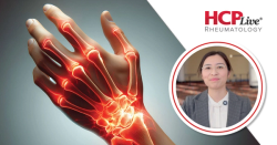 Low-Dose IL-2 Rebalances Immunity in SLE, With Yuebo Jin, MD