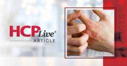 RAD 2026: Tralokinumab Improves Hand AD Outcomes, Outperforms Dupilumab in MAIC